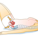 Demystifying Pelvic Floor Dysfunction: Causes, Symptoms, and Treatment